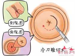 中国单身女性可以用精子库,西安精子库联系方式